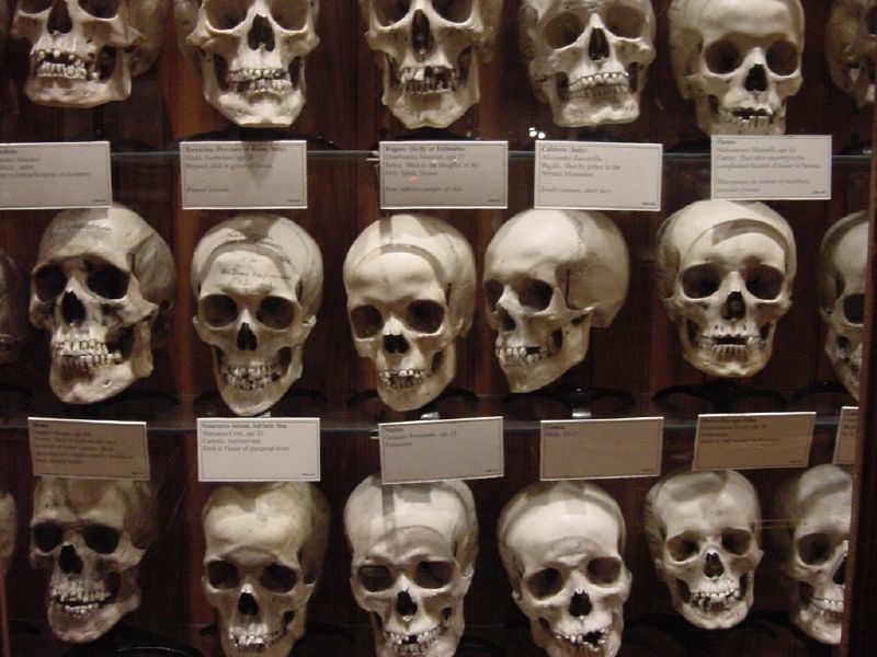 The Mutter Museum