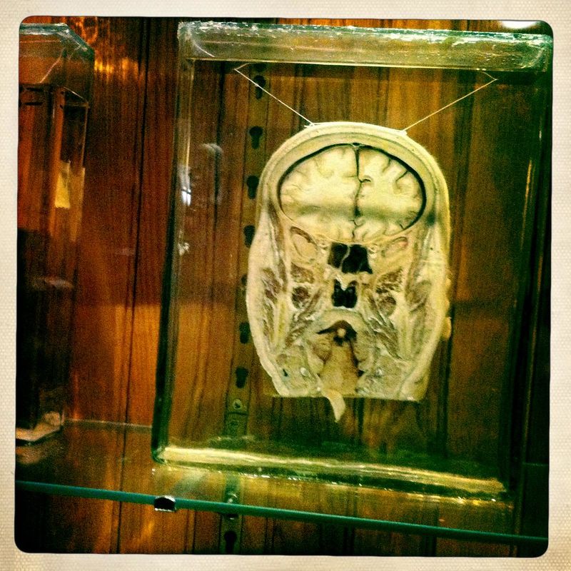 Pennsylvania – Mutter Museum