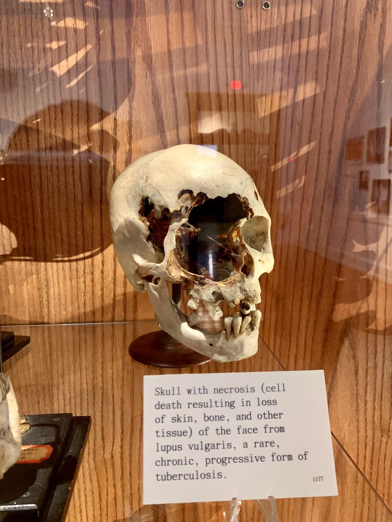 Deformities, Anatomy, and Seeing With Compassion