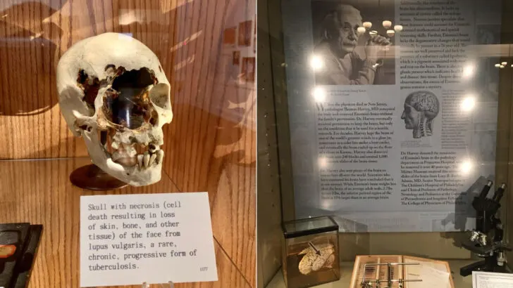 This Philadelphia Museum Displays Einstein&rsquo;s Brain and More Than 130 Human Skulls